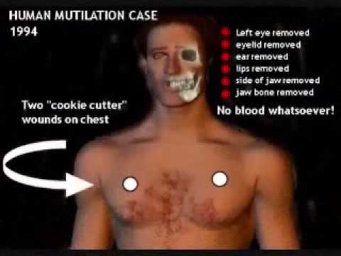 EXTREMELY GRAFFIC ALIEN UFO HUMAN MUTILATION PICTURES YOU CAN'T SEE ON YOUTUBE!!